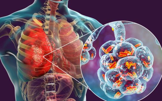 19.01.2026 г. Профилактика внебольничной пневмонии
